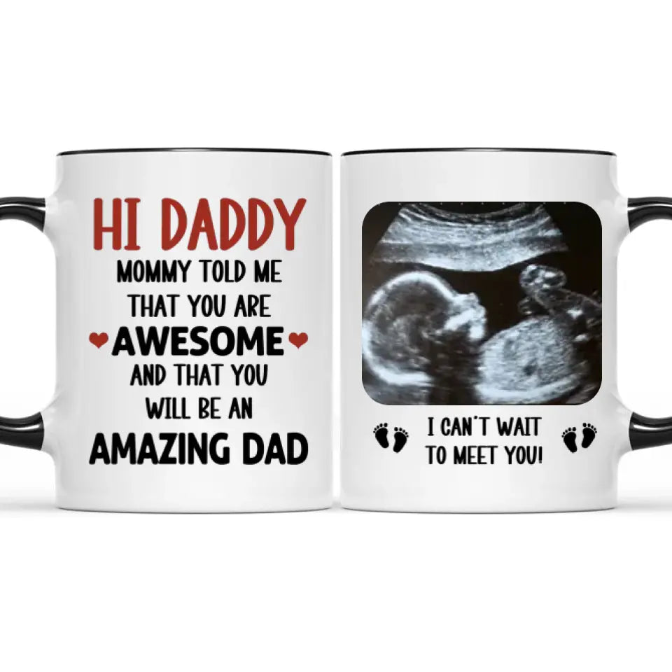 Personalized Mug Gift For Expectant Father - Hi Daddy, Mommy Told Me That You Are Awesome